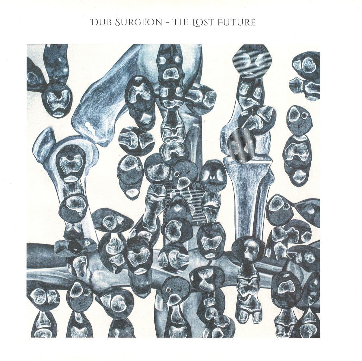 The Lost Future