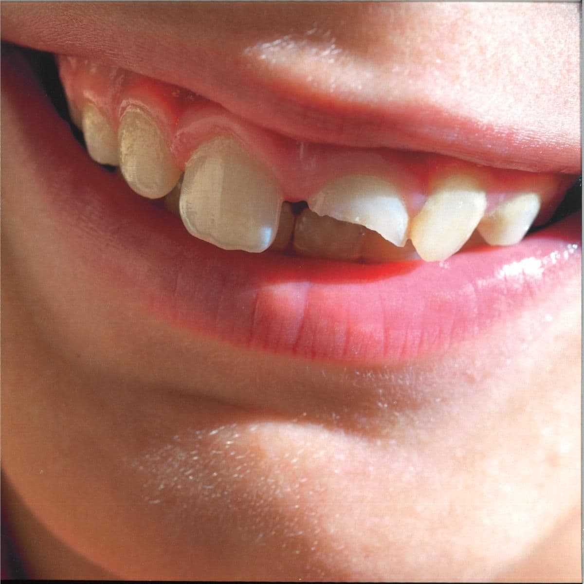 Smiling Through The Pain LP 2x12"